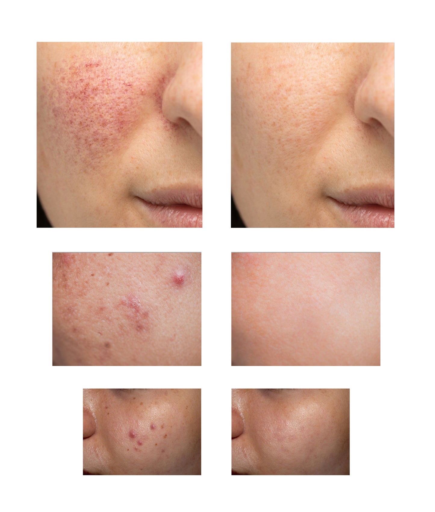 All in One Solution for skin